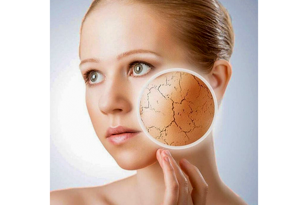 dry-skin-patches-causes-treatment-and-prevention-clinikally