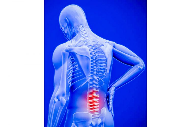 All you need to know about low back pain