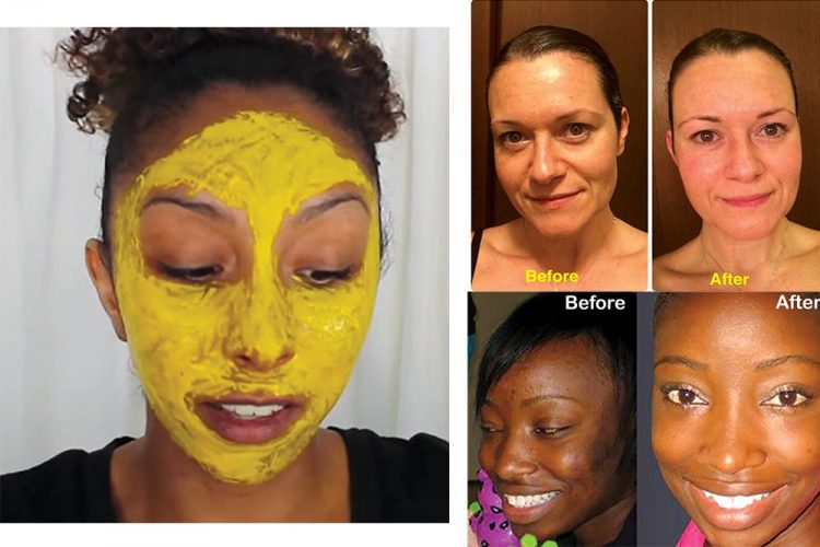 Turmeric facial mask - Searchlight