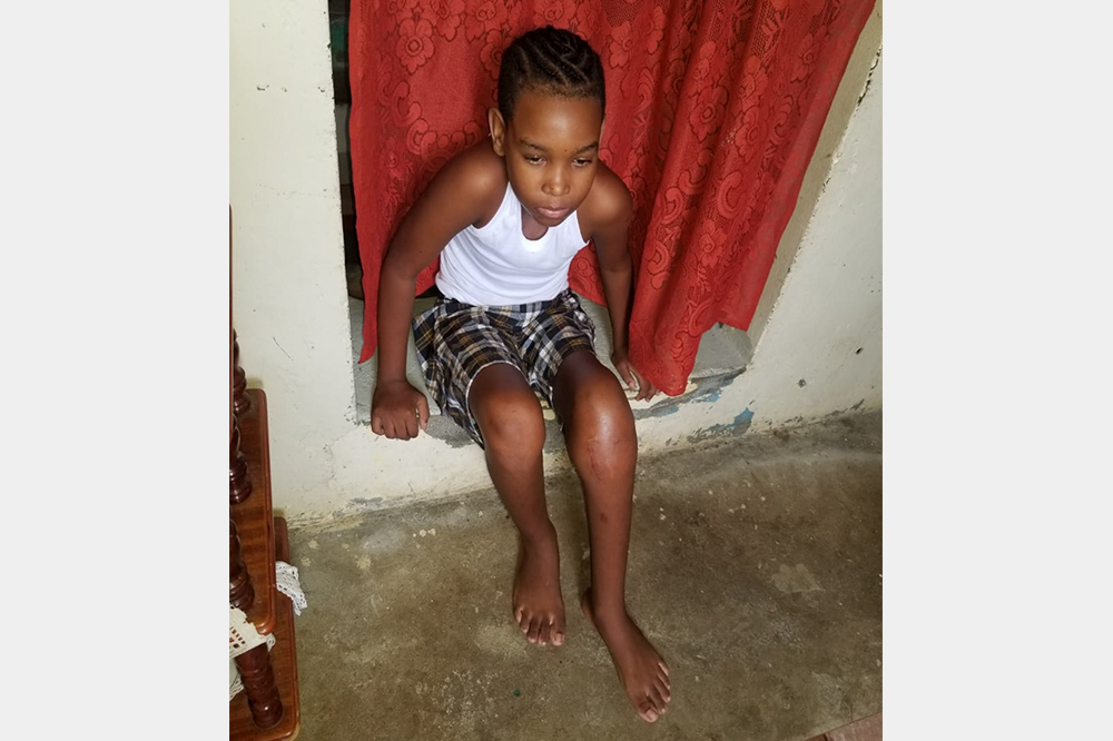 Layou Police Youth Club member loses section of leg to cancer Layou Police Youth Club member loses section of leg to cancer